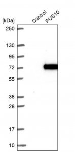 Anti-PUS10 antibody produced in rabbit 