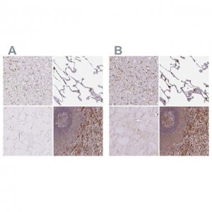 Anti-PYCARD antibody produced in rabbit HPA049074-100UL