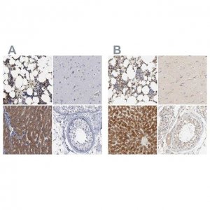 Anti-PYGL antibody produced in rabbit 