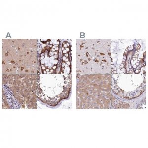 Anti-QARS antibody produced in rabbit 