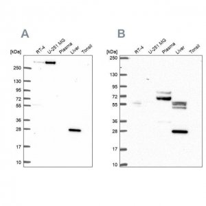 Anti-QDPR antibody produced in rabbit 