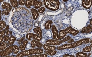 Anti-QPRTase Antibody, clone 1G22 ZooMAb� Rabbit Monoclonal 