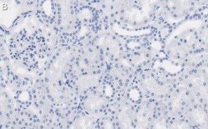 Anti-QPRTase Antibody, clone 1G22 ZooMAb� Rabbit Monoclonal 