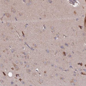 Anti-RAB15 antibody produced in rabbit 