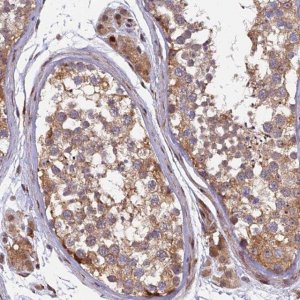 Anti-RAB28 antibody produced in rabbit HPA044575-100UL