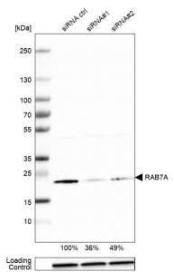 Anti-RAB7A antibody produced in rabbit 