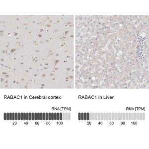 Anti-RABAC1 antibody produced in rabbit HPA029171-100UL
