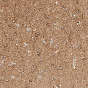 Anti-RABEP1 antibody produced in rabbit 
