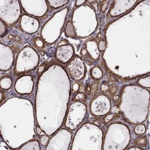 Anti-RABGAP1 antibody produced in rabbit 