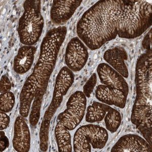 Anti-RABGGTB antibody produced in rabbit 