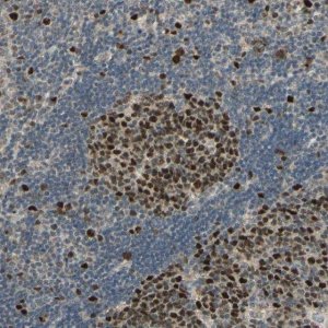 Anti-RAD18 antibody produced in rabbit 