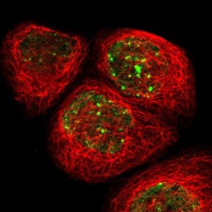 Anti-RAD18 antibody produced in rabbit 