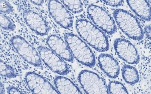 Anti-RAD21 Antibody, clone 2H12 ZooMAb� Rabbit Monoclonal 