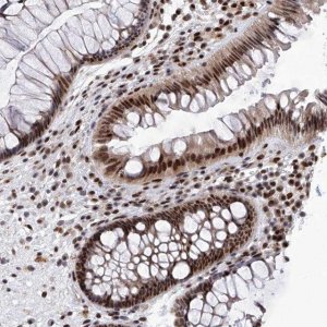 Anti-RAD54L antibody produced in rabbit HPA028954-100UL