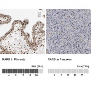 Anti-RARB antibody produced in rabbit 