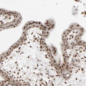 Anti-RARB antibody produced in rabbit 