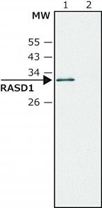 Anti-RASD1 SAB4200487-200UL