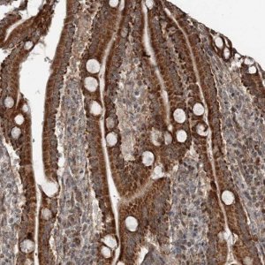 Anti-RASSF8 antibody produced in rabbit 