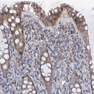 Anti-RASSF9 antibody produced in rabbit 