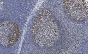 Anti-Rb Antibody, clone 2M15 ZooMAb� Rabbit Monoclonal 