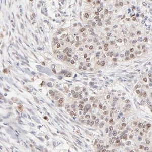 Anti-RBM3 antibody produced in rabbit 