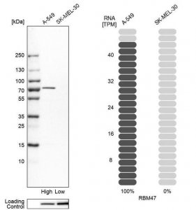 Anti-RBM47 antibody produced in rabbit 