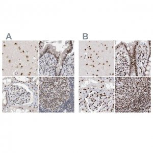Anti-RBM6 antibody produced in rabbit 