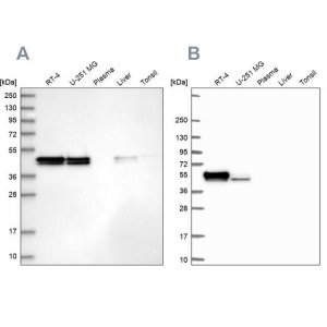 Anti-RCN1 antibody produced in rabbit 