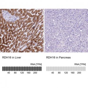 Anti-RDH16 antibody produced in rabbit HPA038518-100UL