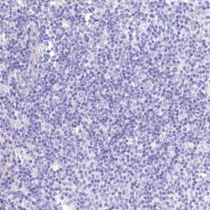 Anti-RDH16 antibody produced in rabbit HPA038518-100UL