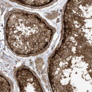 Anti-REPS1 antibody produced in rabbit 