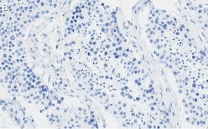 Anti-REST Antibody, clone 2E3 ZooMAb� Rabbit Monoclonal 
