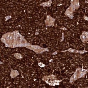 Anti-REXO2 antibody produced in rabbit HPA038450-100UL