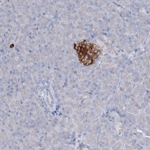 Anti-RFX6 antibody produced in rabbit 