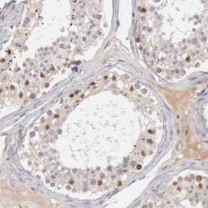 Anti-RGAG1 antibody produced in rabbit 