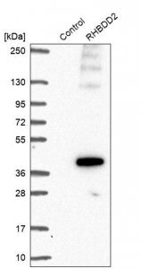Anti-RHBDD2 antibody produced in rabbit HPA051960-100UL