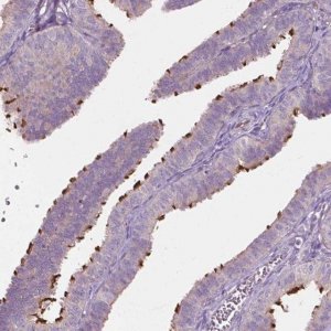 Anti-RIIAD1 antibody produced in rabbit 