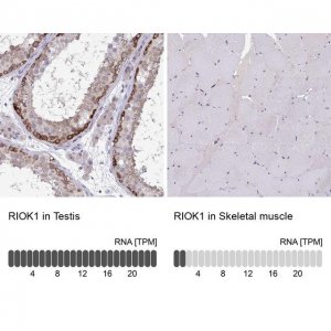 Anti-RIOK1 antibody produced in rabbit 