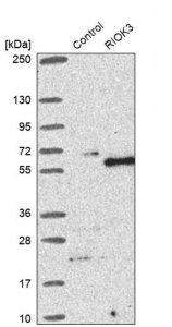 Anti-RIOK3 antibody produced in rabbit 