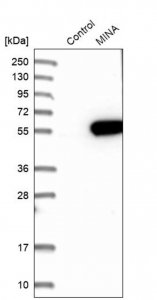 Anti-RIOX2 antibody produced in rabbit HPA007603-100UL