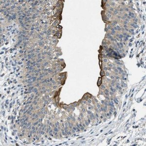 Anti-RIPK2 antibody produced in rabbit 
