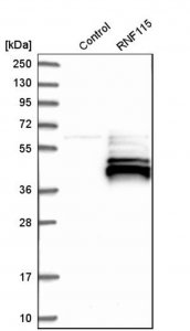 Anti-RNF115 antibody produced in rabbit 