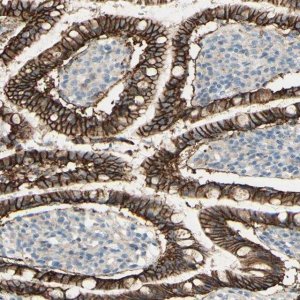 Anti-RNF149 antibody produced in rabbit 