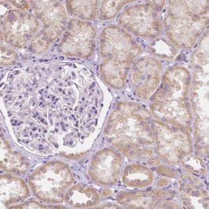 Anti-RNF186 antibody produced in rabbit 