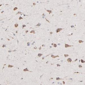 Anti-RNF213 antibody produced in rabbit 