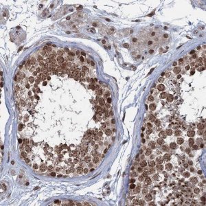 Anti-RNF6 antibody produced in rabbit 