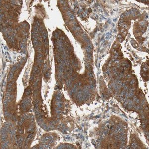 Anti-ROCK2 antibody produced in rabbit 