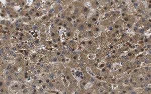 Anti-ROR Antibody, clone 1D13 ZooMAb� Rabbit Monoclonal 