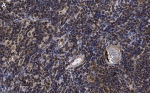 Anti-ROR Antibody, clone 6F3.1 ZooMAb� Mouse Monoclonal 