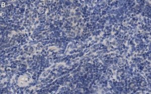 Anti-ROR Antibody, clone 6F3.1 ZooMAb� Mouse Monoclonal 